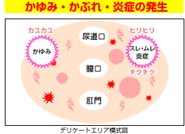 陰部のどこが痒い？