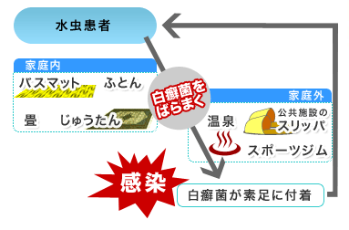 水虫の感染源